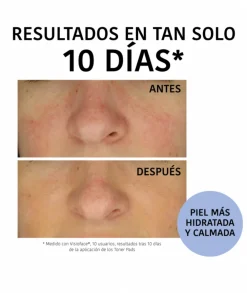 IROHA NATURE Tónico Hidratante Discos Cica 10 Und.| Tónico Facial